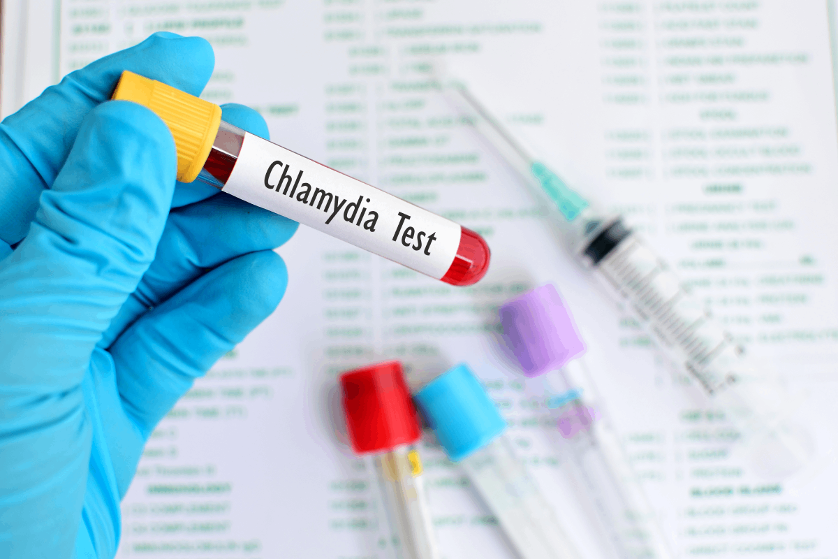 The Laboratory Diagnosis of Chlamydia