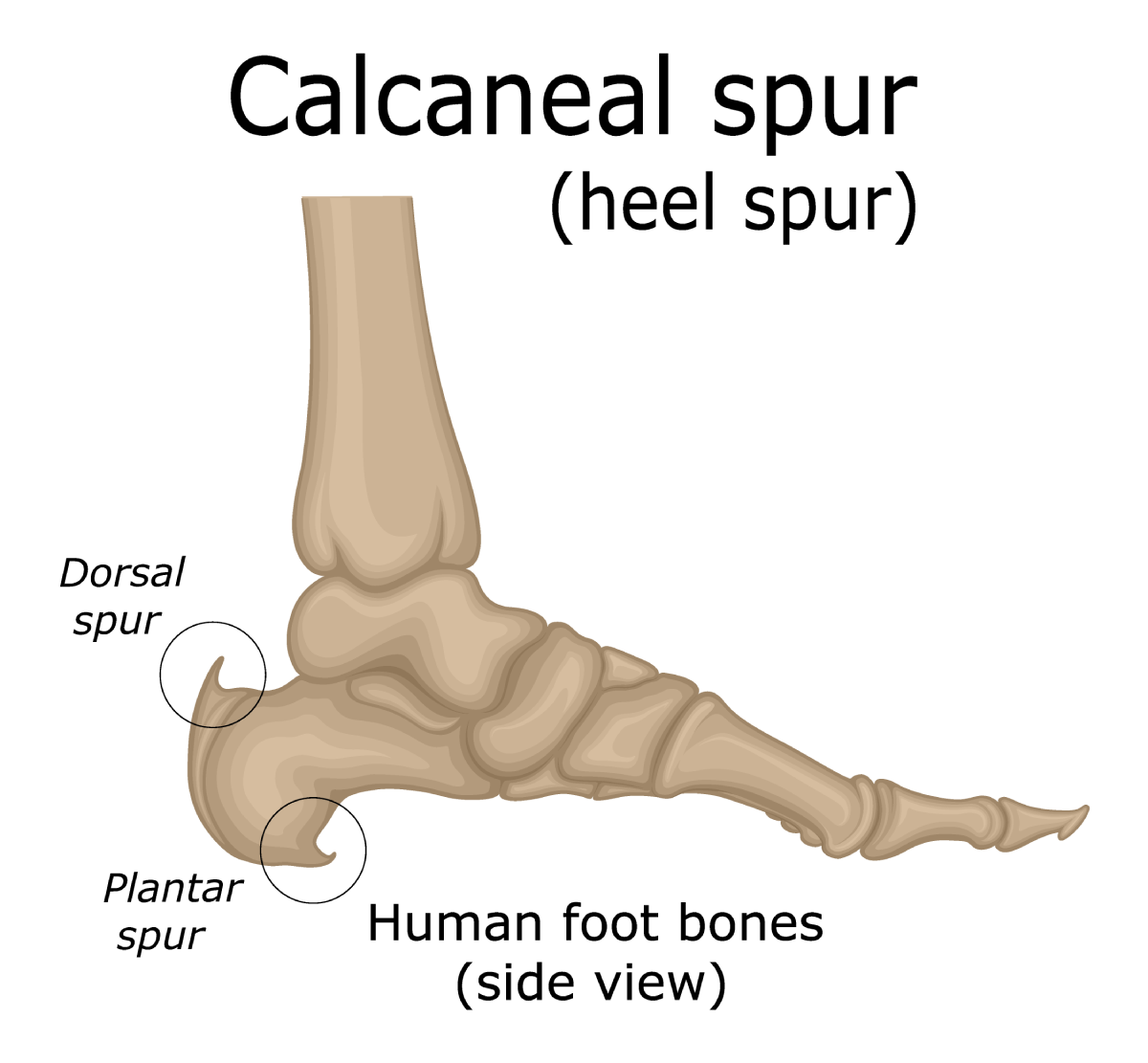 Overview of Foot Anatomy. Plantar Fasciitis.