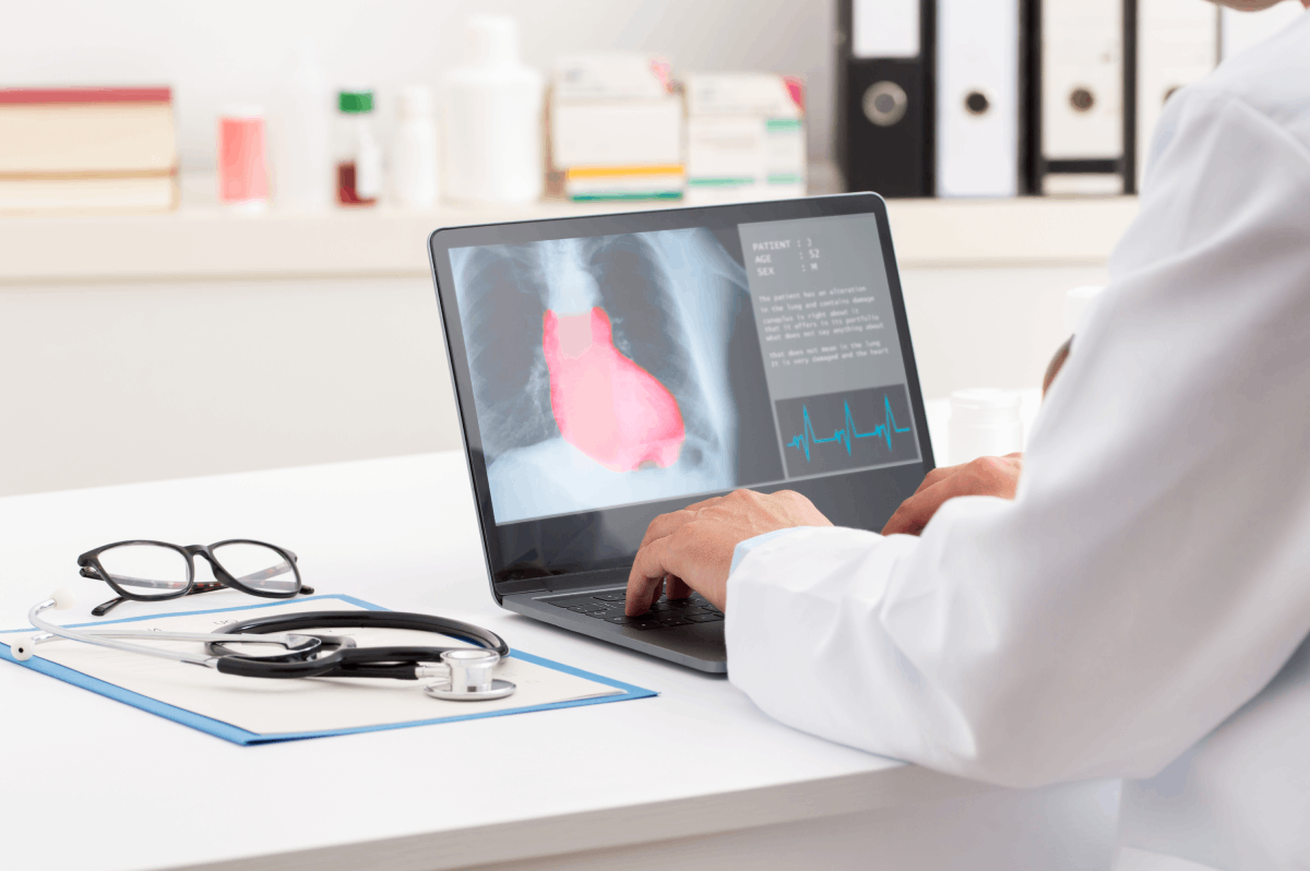 Chronic Heart Diseases and COVID-19
